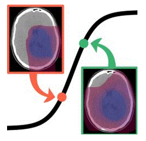 Modeling and Biostatistics in Radiation Oncology